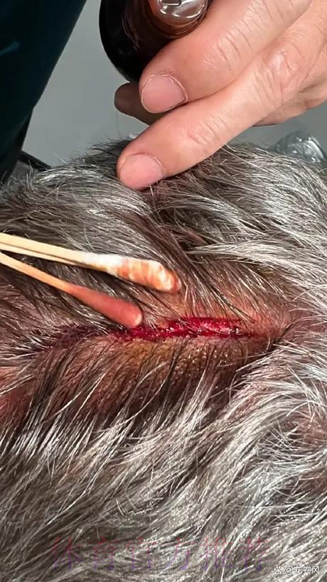 安帅:想以微弱优势晋级 2粒上角的进球不可能扑出 安帅:想以微弱优势晋级 2粒上角的进球不可能扑出